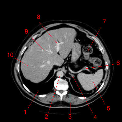 Atlas of CT Anatomy of the Abdomen - W-Radiology