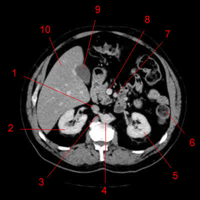 洋書 CT and MRI of the abdomen and pelvis CT and MRI of the Abdomen and Pelvis: A Teaching File
