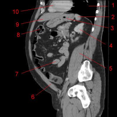 Atlas of CT Anatomy of the Abdomen - W-Radiology