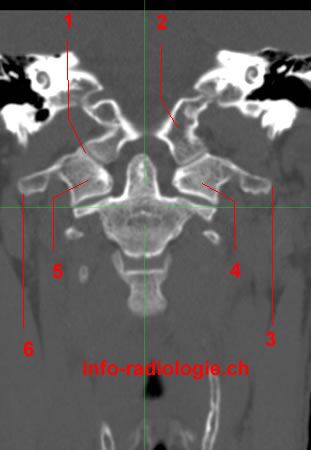 頭頸部画像解剖ナビゲーション = NAVIGATION OF IMAGING … Imaging Head and neck spaces - YouTube